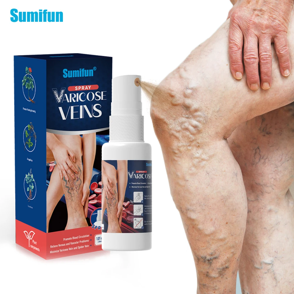 

30ml Sumifun Varicose Vein Spray Treat Vasculitis Phlebitis Pain Relief Cream Varicosity Angiitis Legs Spider Removal Plaster