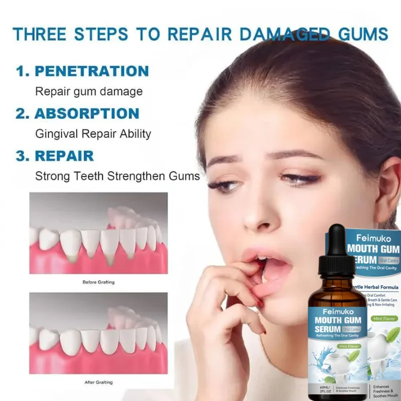60ML Gentle Natural Gum Care Liquid Soothe Oral Discomfort Help Maintain Healthy Gum Condition Daily Oral Hygiene Care - 3