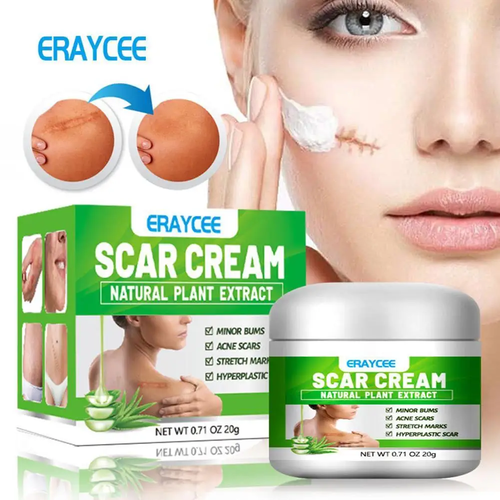 

Natural Plant Acne Stretch Scar Removal Cream Repair Skin Scars Surgery Scars Stretch Marks Acne Pox Prints Burn Facial Care Gel