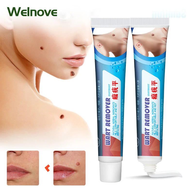 

1/2/3Pcs Effective Wart Remover Cream Plantar For Feet Warts Ointment Neck Face Armpits Antibacterial Painless Skin Repair