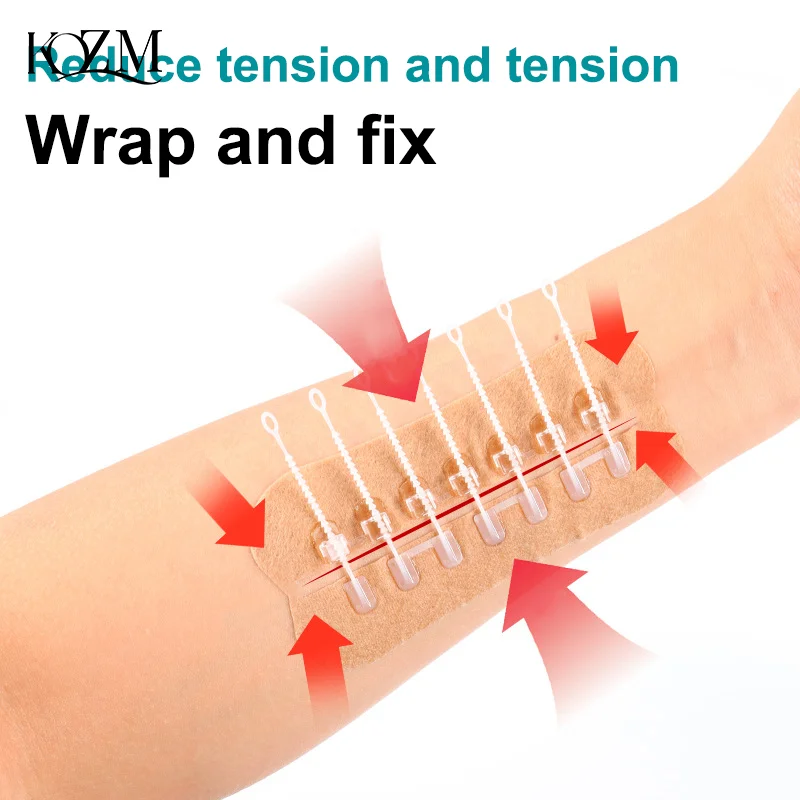 Zipper Wound Closure Patch 3