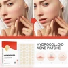 144pcs/set Face Skin Care Acne Pimple Patch 2 Sizes Invisible Professional Healing Absorbing Spot Sticker Covering for Men Women 2