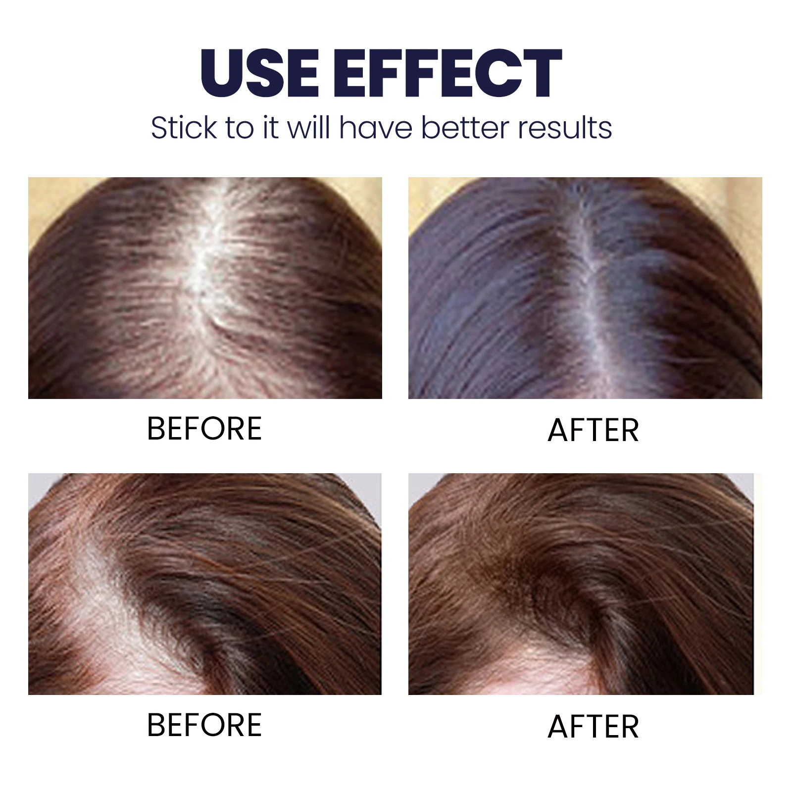 OUHOE Hair Growth Spray Designed To Strengthen Stop Hair Loss Natural Essence Repair & Strengthen Follicles Spray
