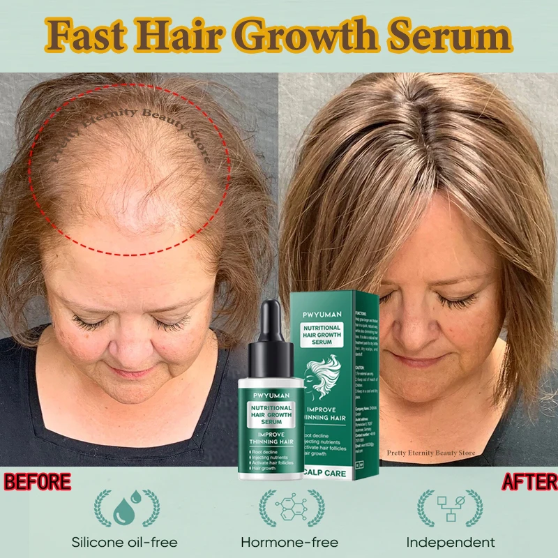 

Fast Hair Growth Serum Prevent Hair Loss Repair Baldness Essential Oil Nourish Hair Follicles Scalp Treatment Hair Care Products