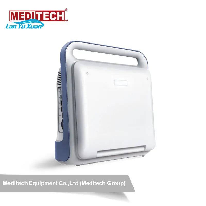 Рисунок 5 - Портативный фотоаппарат для фото-и