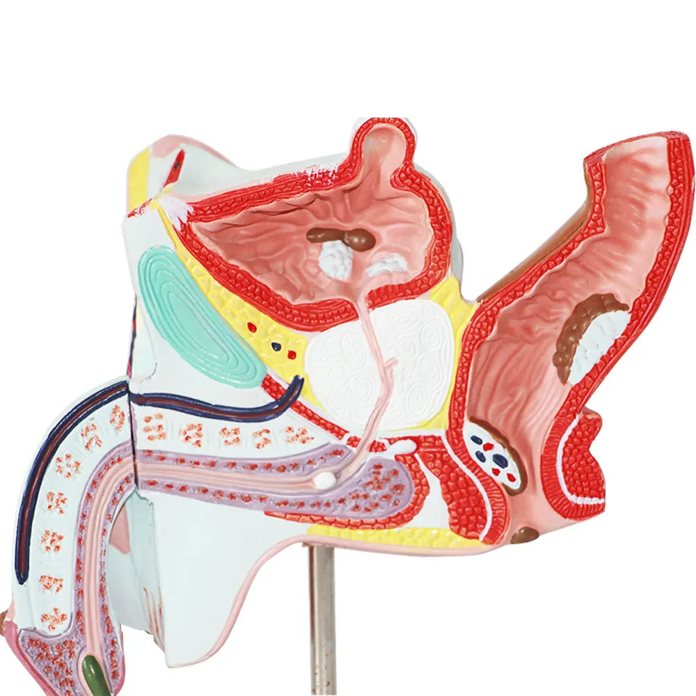 Male anatomical model of internal and external organs Male gonorrhea model Medical teaching equipment
