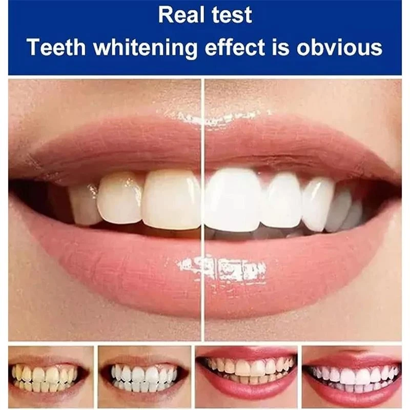 teeth whitening product teeth whitening essence teeth health product SP-7 Toothpaste Oral Health Management Deep Probiotic Whitening Toothpaste Fresh Breath Triple Whitening Teeth Product