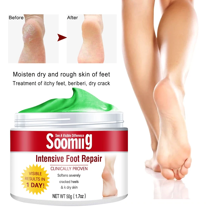 

Soomiig Anti-cracking Foot Cream-Applicable To Hands, Feet, Legs Dead Skin, Calluses, Restore Smooth and Delicate Skin