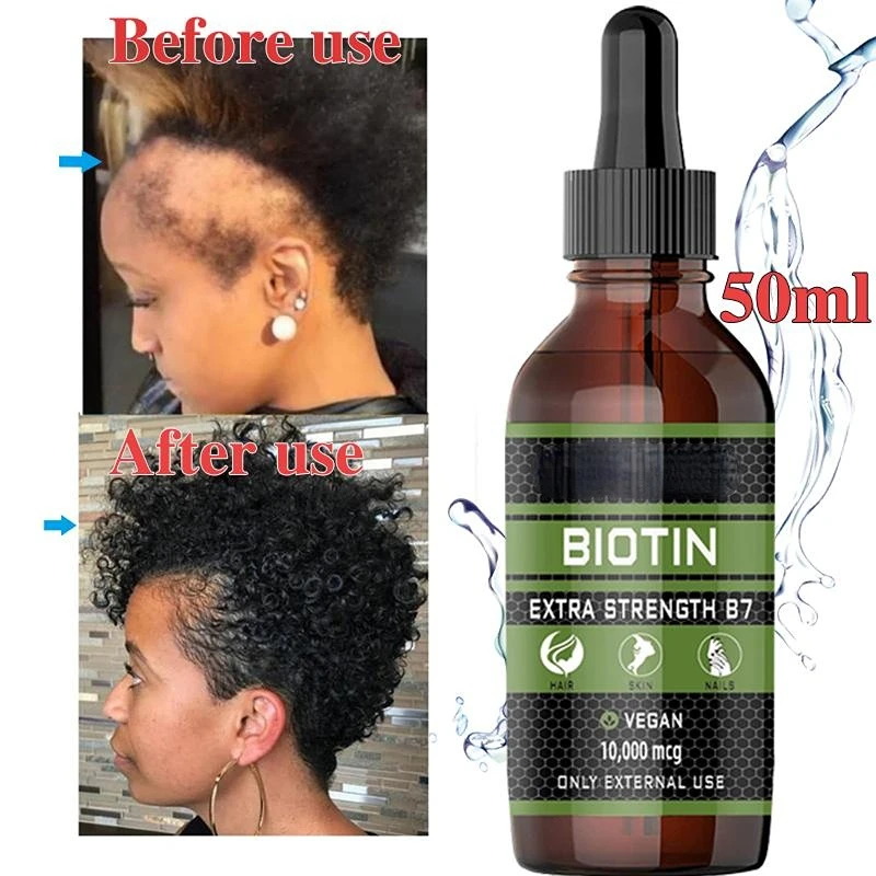 2022 Natural Hair Care Products Natural Anti Alopecia Prevention Alopecia  Treatment Rapid Growth Nutrition Dry Damaged Hair Care - Hair Loss Product  Series - AliExpress