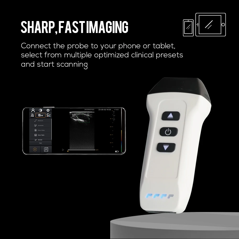 Professional Medical Portable Color Doppler 128 Elements