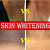 Whitening Cream Private Parts Underarm Bleaching Serum Whiten Butt Knee Brighten Inner Thigh Intimate Parts Dark Remove Melanin 3