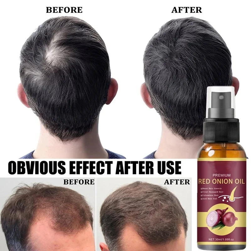 Powerful Hair Growth Serum Spray Repair Hair Nourish Root Regrowth Hair Anti Hair Loss Treatment Essence For Men Women Hair Care images - 6