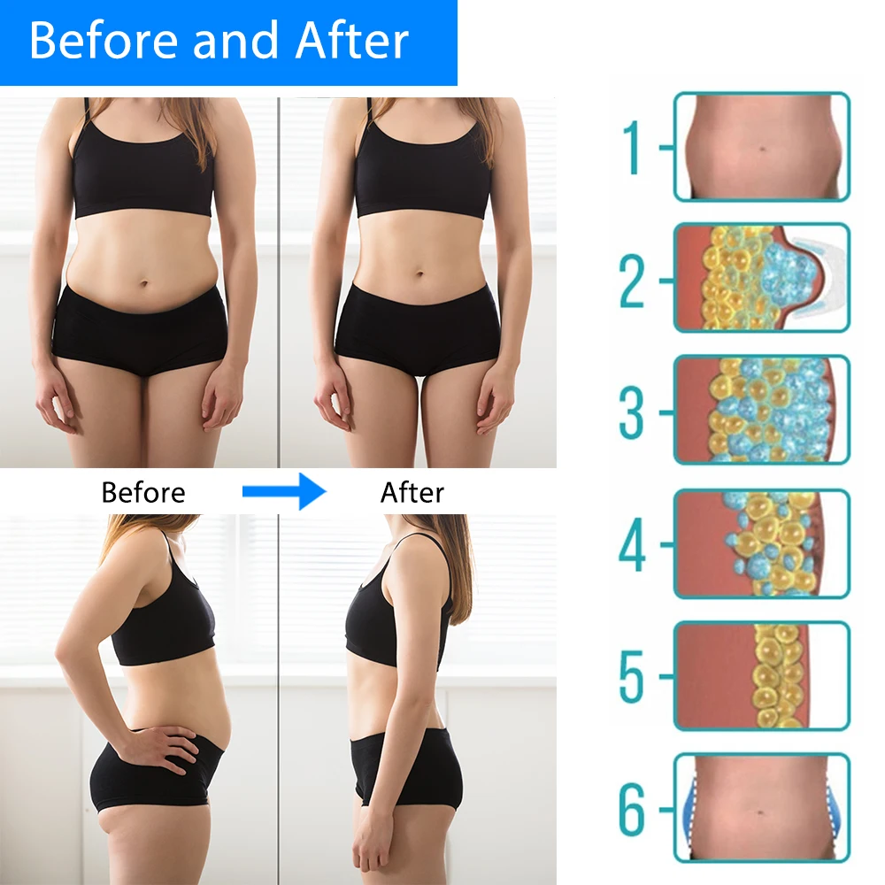 Cryotherapy Body Slimming Weight Losing Fat Freezing Machine Belly Burning Anti-Cellulite Massager Cryolipolysis Remove Fat 3