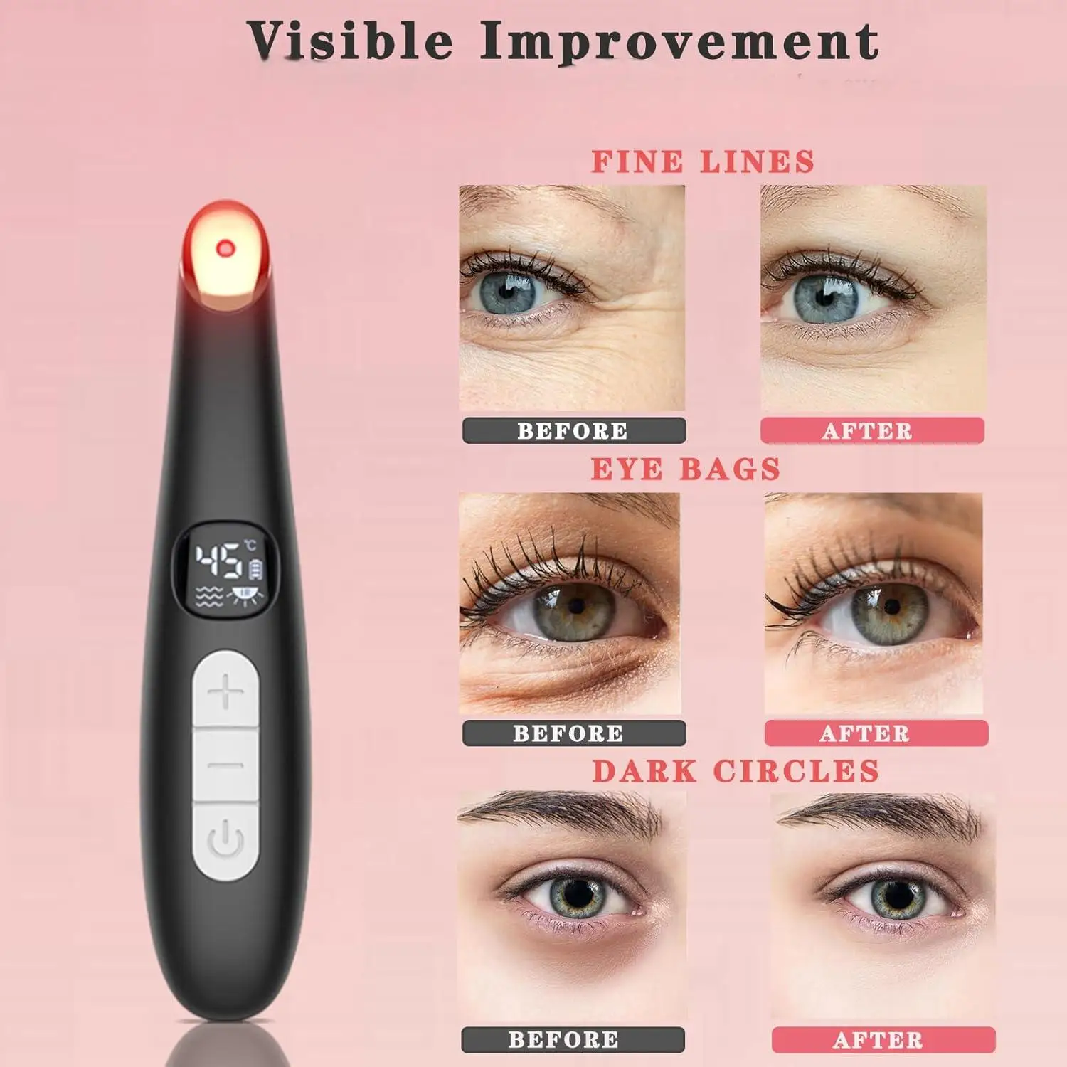 3 in 1 Eye Lift Wand Beauty Device Vibrating Red Light 98°F to 113°F LCD Display Eye Massager for Dry Eye Dark Circle Puffiness