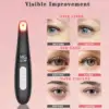 3 in 1 Eye Lift Wand Beauty Device Vibrating Red Light 98°F to 113°F LCD Display Eye Massager for Dry Eye Dark Circle Puffiness 2