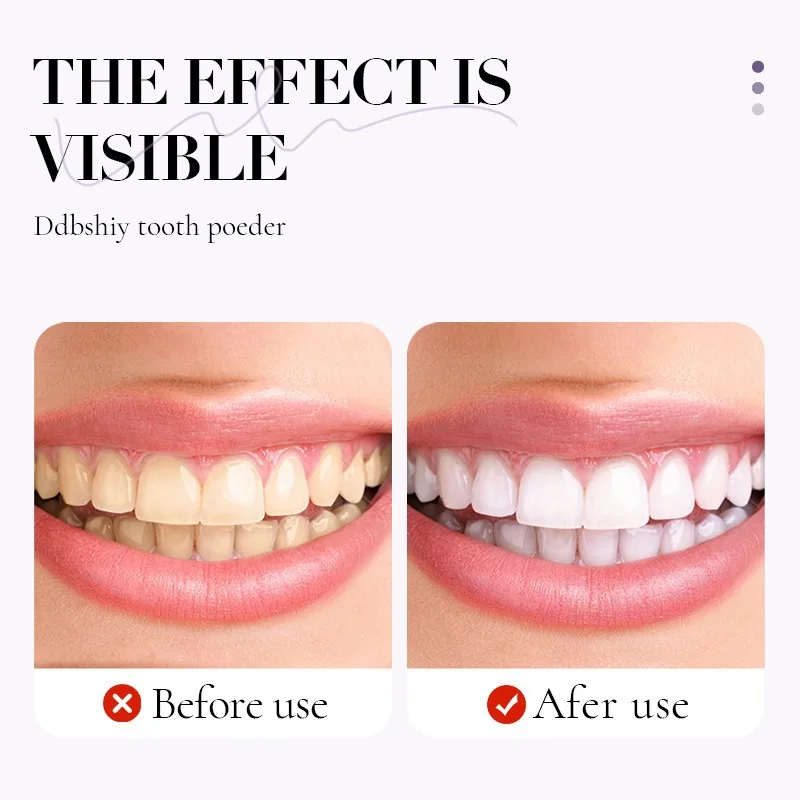 Polvere Sbiancante per Denti Invernale con 10% di Idrossiapatite - Rimineralizzante, Menta Fresca, Riparazione dello Smalto e Alito Fresco - immagine 5