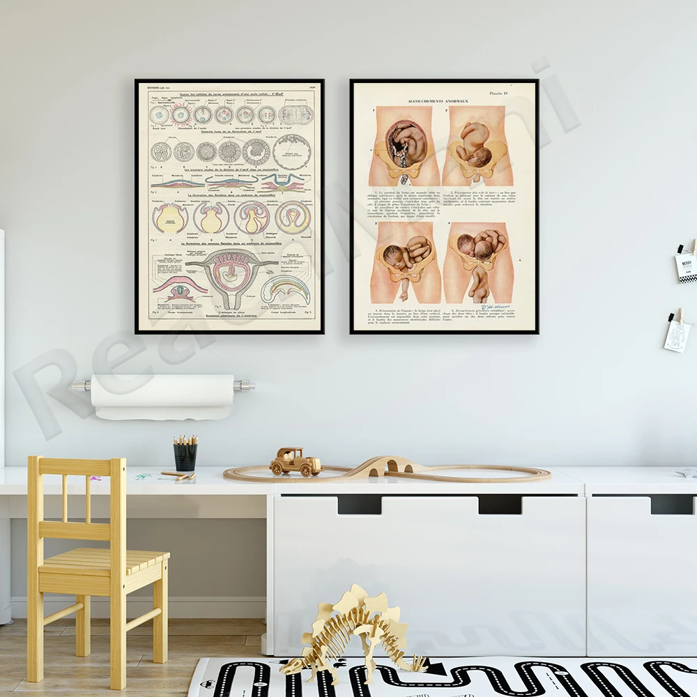 

Antique Pregnancy Body Anatomy, 1950's Vintage Delivery Anatomy Print, Vintage Medical Poster. PhD professor gift decoration