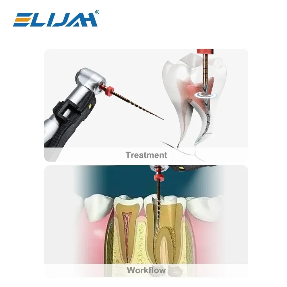 Dental Root Canal Files Set 2