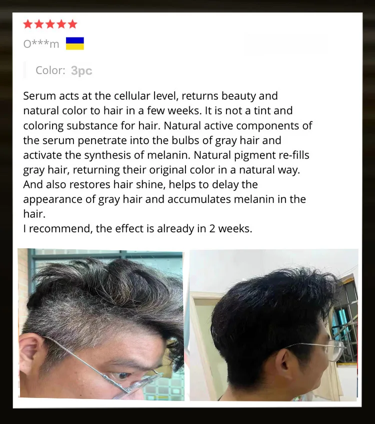 Description Picture 2 of itemAnti Gray Hair Serum Remedy White Darkening