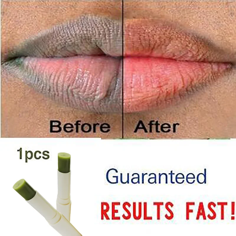 The Green Fresh Brightening Lip Cream Treatment removes dark lips. green me lips