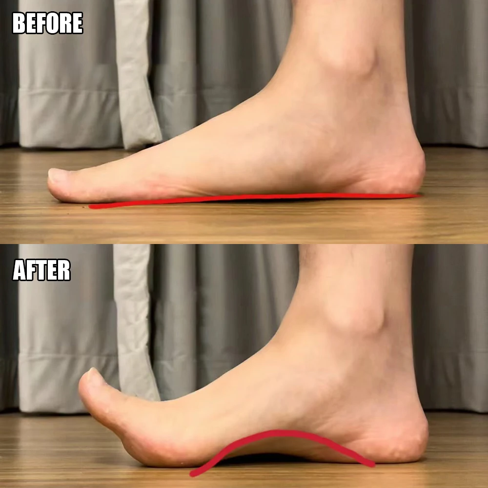 Orthopedic Insoles 1 Pair Unisex Orthopedic Insole Orthosis Flat Foot Support Health Arch Collapse Support Pad Foot Care Professional