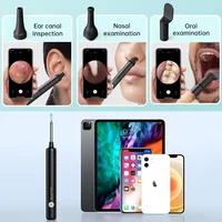 2024 Bebird ENT Observation Kit Set (Not Include Camera Device） 1