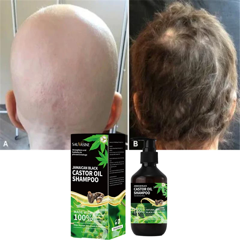 200ML Hair Growth Shampoo Jamaican Castor Oil Shampoo Quickly Strengthen Hair Roots Anti Hair Loss Products For Men For Women