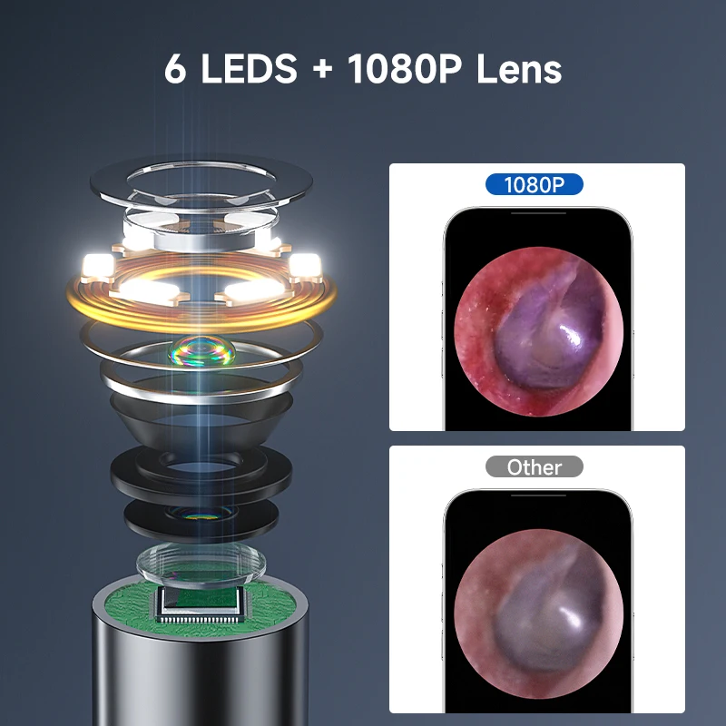 WiFi Connect Visual Otoscope Camera for with 6 LEDs 4.2mm Ultra Thin Otoscope Ear Wax Removal Tool with Waterproof 1080P Camera 2