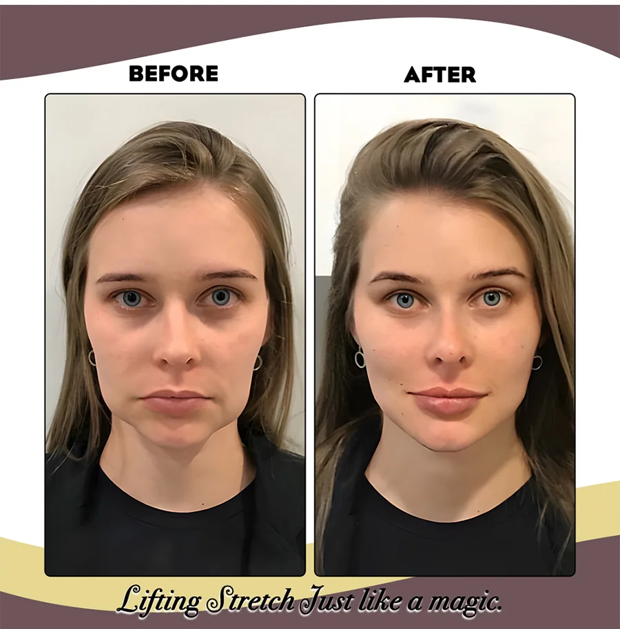 Instant Facelift Band Mit Haar Clip Stelle Einstellbar Gummibänder Für Straffende Haut Satzung Linien Auge Taschen Falten Entfernen Haar bands – Detail 3