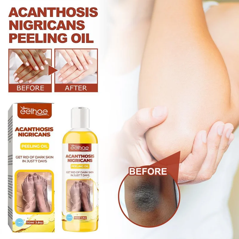 

110ml Whitening Body Serum Bleaching Brightening Skin Yellow Peeling Oil Lightening Exfoliating Dark Spot Serum Exfoliating Oil
