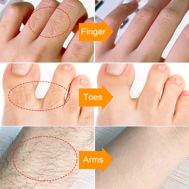 Wax Painless Hair Remover Ladies Epilator Cream Skin Care Lip Underarm Private Bikini Body Beauty Face Depilation Hair Removal 3