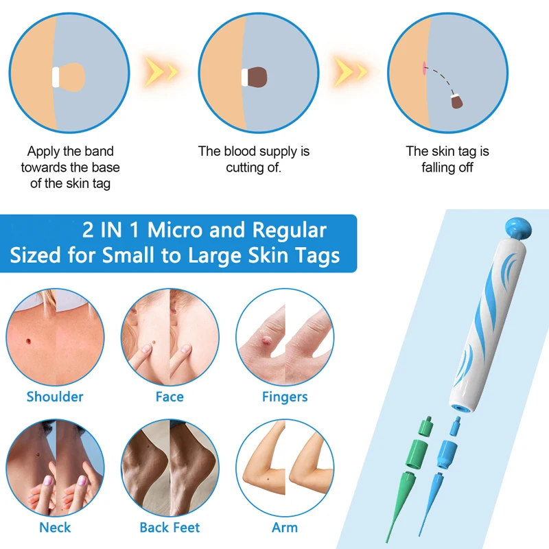 New 2 in 1 Auto Skin Tag Remover Kit Skin Tag Removal Pen With 40 Bands Wart Dot Treatment Remover Tool For Face Skin Full Body