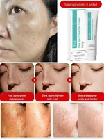Crème blanchissante puissante pour éliminer les taches, éclaircit la peau, élimine rapidement la Pigmentation de la mélanine, mélasma, taches foncées, Gel de beauté hydratant 3