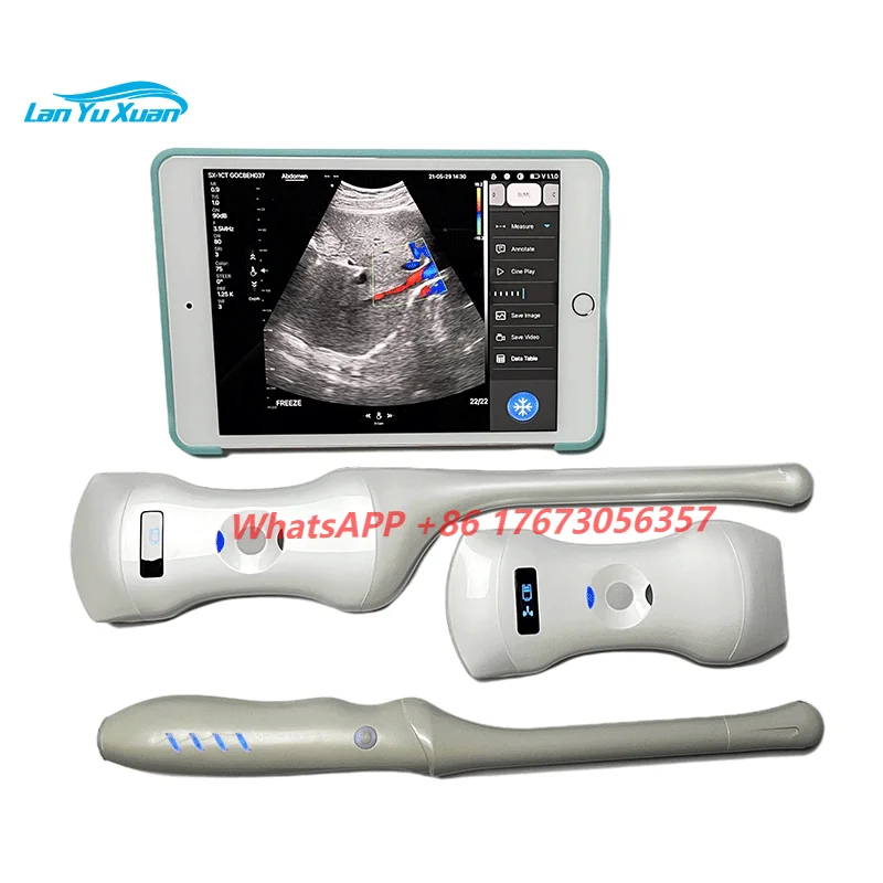 

Handheld Linear Convex Phased Array 3 In 1 Double Probes WiFi Ultrasound Probe