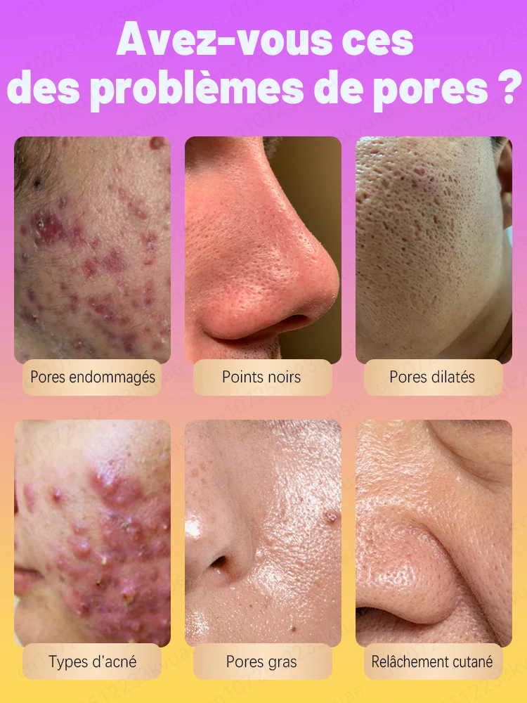 Pore shrinking essence, lighten pores, remove wrinkles, and restore 18-year-old skin