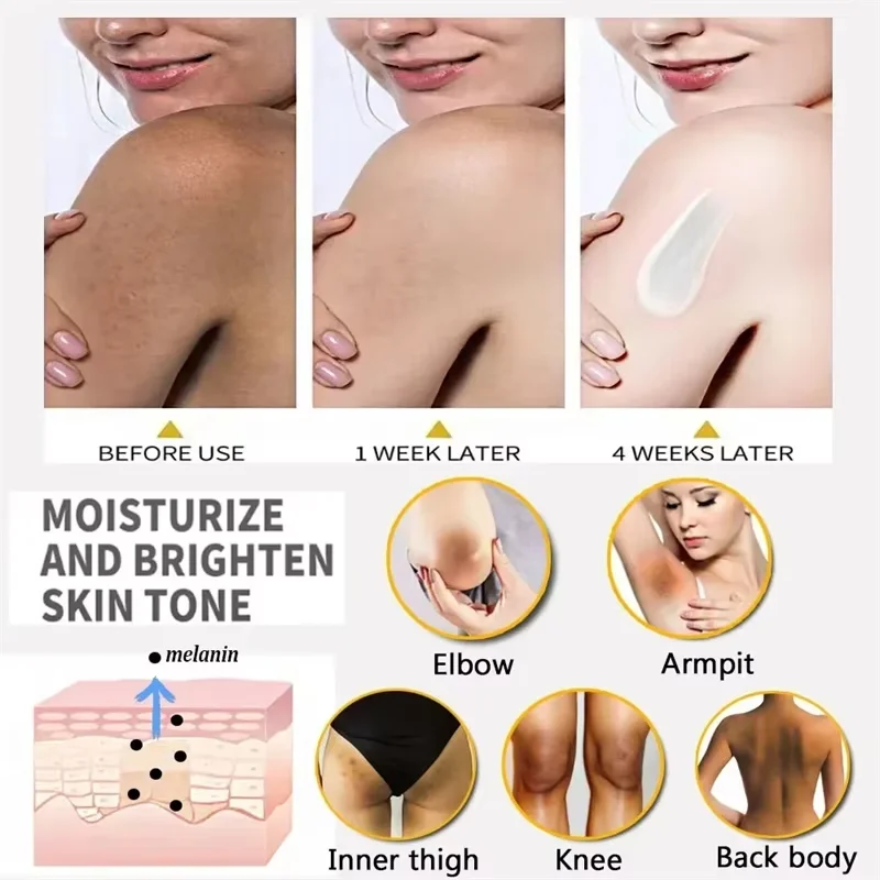 Nicotinamide Brightening Cream For Dark Skin Effective Lighten Thigh Inner Bleach Remove Melanin Private Parts Brighten Cream 5