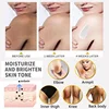 Nicotinamide Brightening Cream For Dark Skin Effective Lighten Thigh Inner Bleach Remove Melanin Private Parts Brighten Cream 5