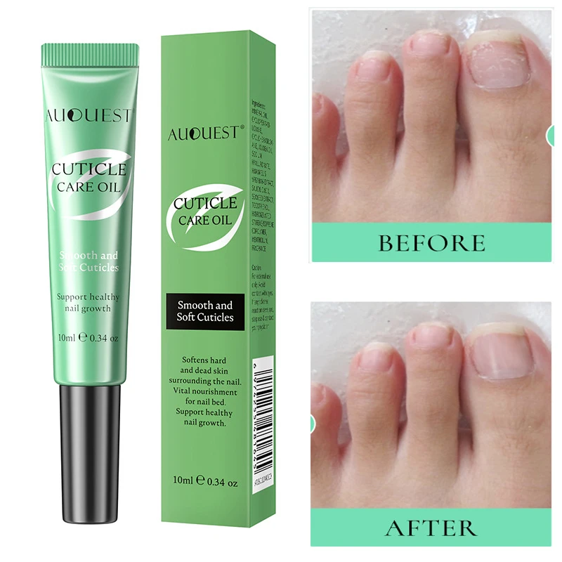 Nail Nutrition Oil Pen Nail Cuticle Regrowth Prevent Finger Foot Fungus