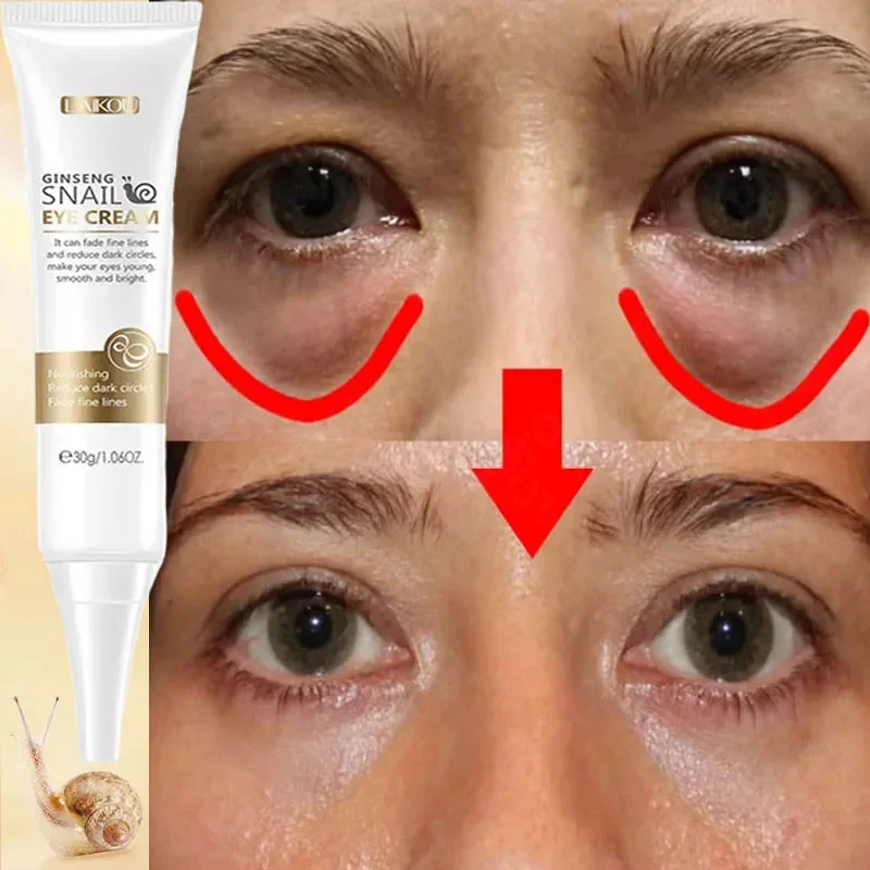 

Snail Wrinkles Remover Eye Cream Anti-aging Puffiness Fade Fine Lines Remove Dark Circles Eye Bags Firming Moisturizing Eye Care