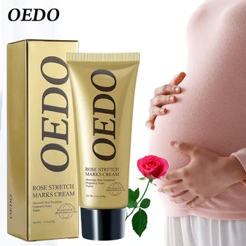 OEDO 스트레치 마크 크림, 스트레치 마크 제거, 임산부 피부 회복, 탄탄한 피부, 바디 로션, 바디 케어