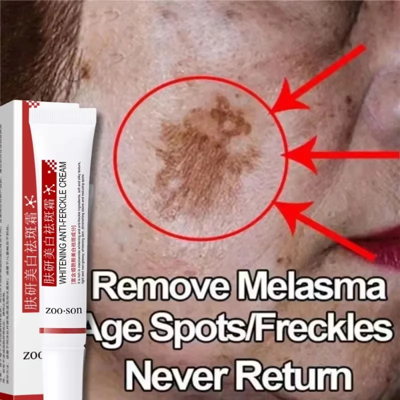 Dark spots remover Whitening serum Face freckle Melanin correcting Anti pigmentation Brighten essence cream Korean skin care