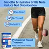 60pcs/set Nail Repair Patches Non Irritating Nail Ingrowning Toenail Corrector Stickers Helps With Cracked Nails 5