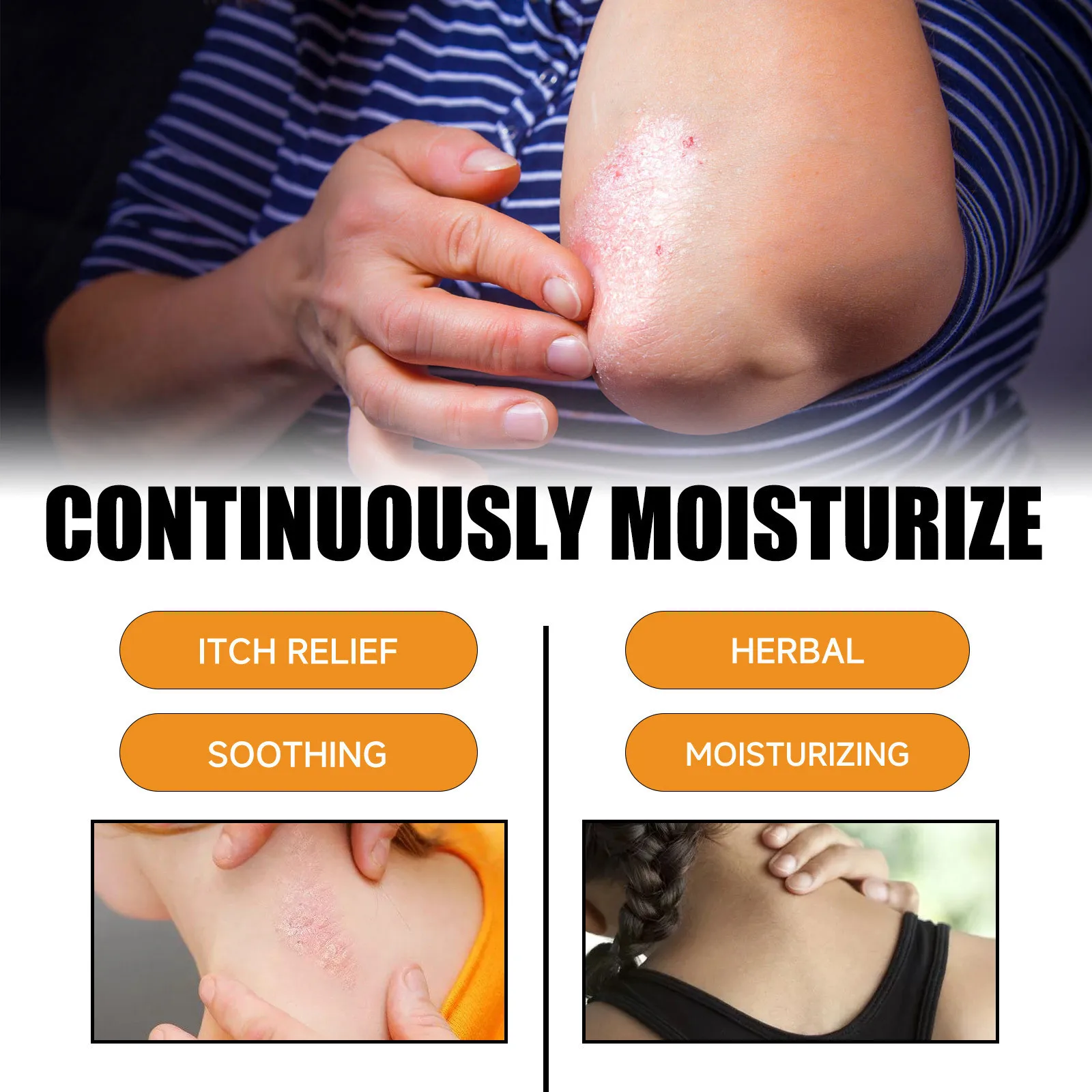 Seborrheic Dermatitis Spray Psoriasis Eczema Fungal Treatment Repair Itching Skin Redness Soothing Eczema Antibacterial Spray