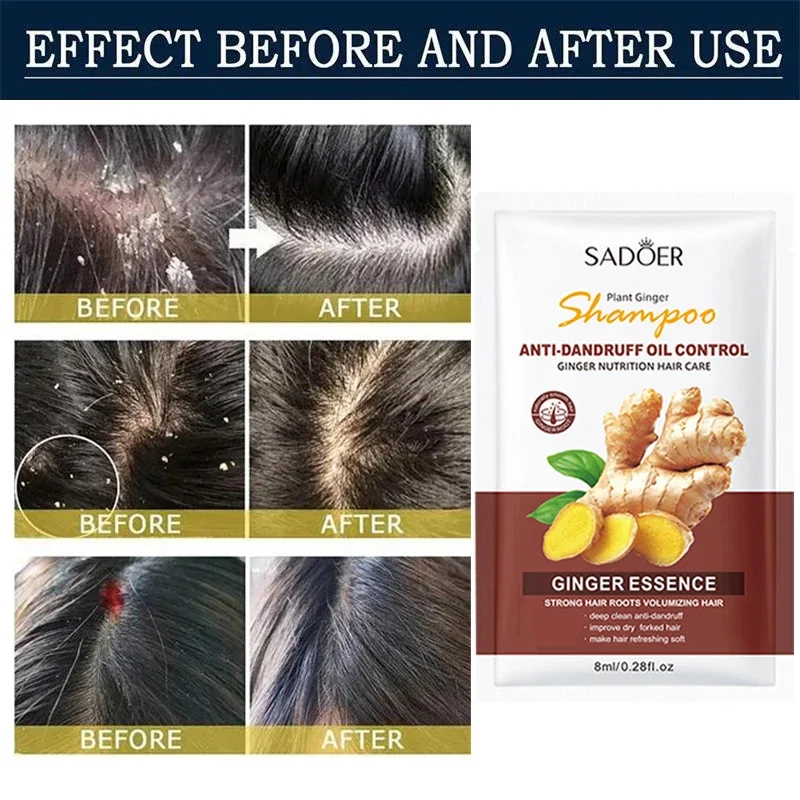 Hair Shampoo Anti-Dandruff Anti-Itch Shampoo Fast Cleaning Repair Scalp Treatment Products Oil Control Antibacterial Mite Hair Care Men Women
