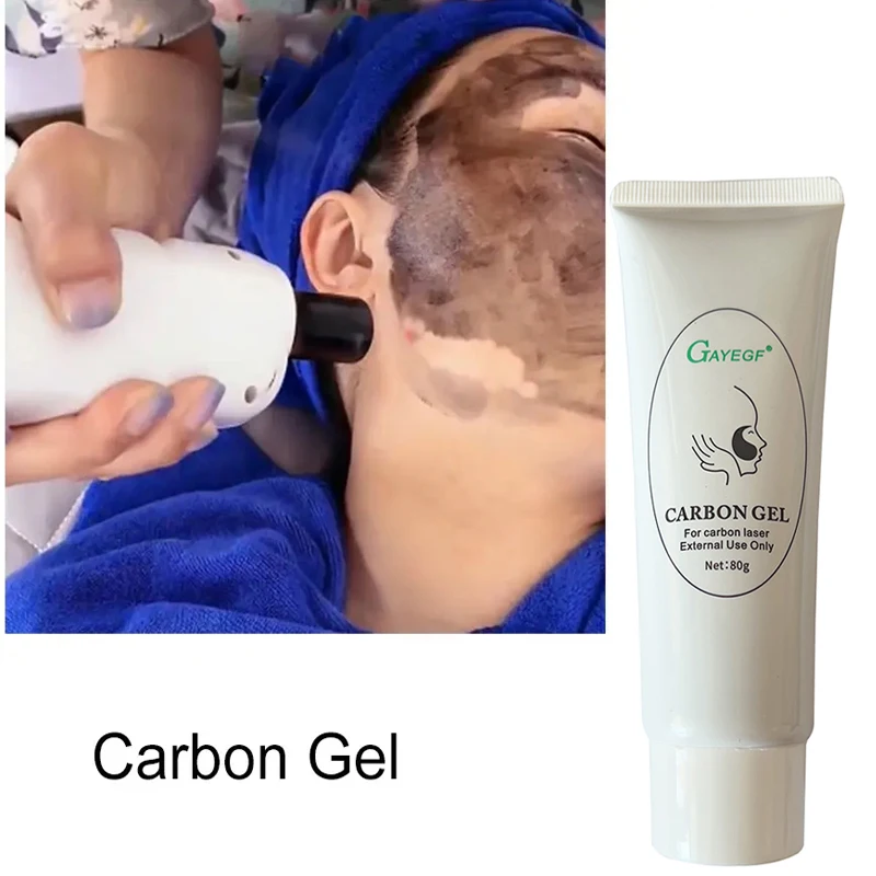 Carbon Cream Black Gel for ND YAG Laser Skin Peeling Skin Rejuvenation Moisturizing Face Cream Facial Whitening Deep Cleaning 5