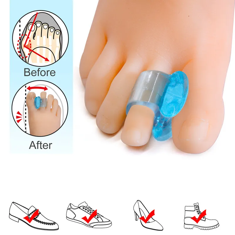 RHBJ 10Pair = 20Pcs Toe Protector Silicone Bunion Corrector Thumb Valgus Protector Nail Tools Foot Care Toe Separator