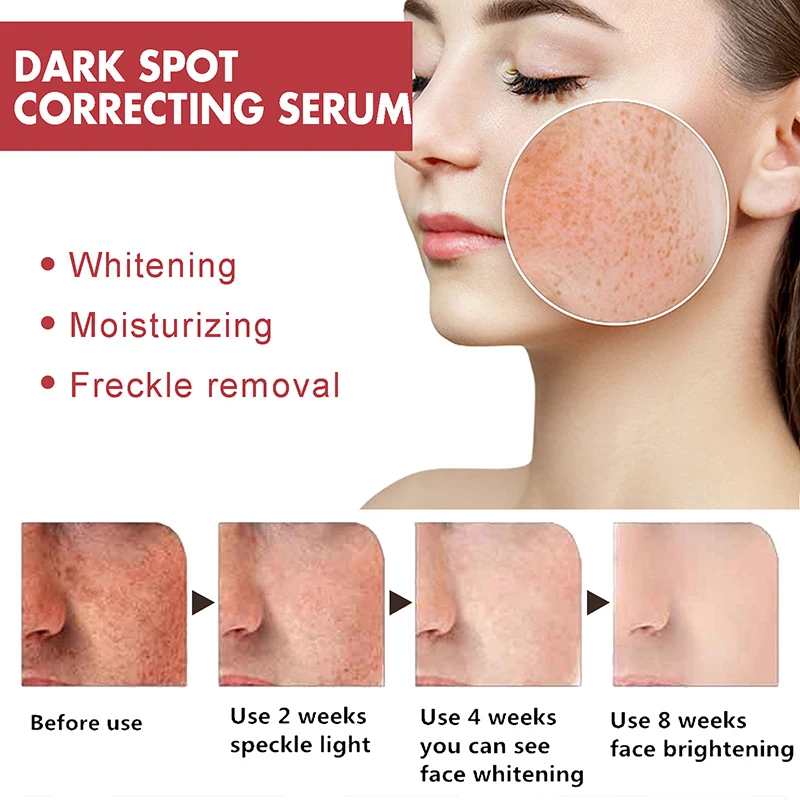 Dark Correcting Essence 10% Niacinamide+ 4% Tranexamic For Post-Acne Marks Acne Hyperpigmentation Even Skin Tone Serum facial essence