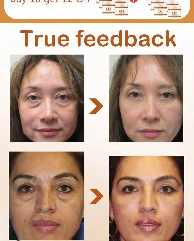 Description Picture 4 of item26 Anti-Aging Moisturizer Eye Cream Dilutes Around The Eyes To Remove Dark Circles, Eye Bags, Collagen Firming Eye Cream