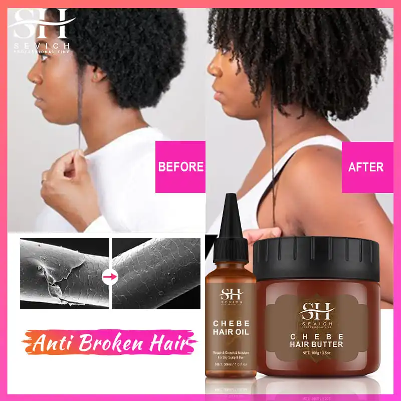 Africa Traction Alopecia Hair Growth Oil 100g Anti-break Moisturize Hair Mask Hair Loss Treatment Crazy Thicken Hair Care Sevich mellow all metal nf v6 crazy heat break copper