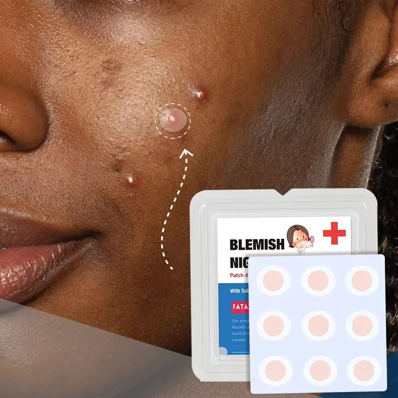 Acne Treatment Patch Repairing Microneedle Spot Blemish Removal Skincare